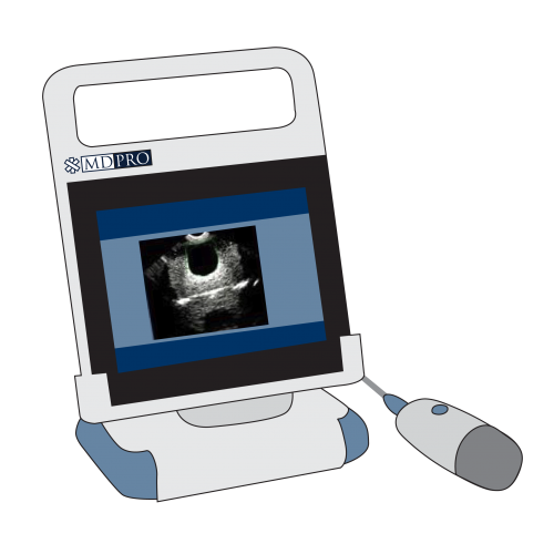 bladder scanner bladder scanner