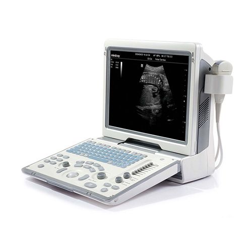 MINDRAY-DP-50-portable-ultrasound-machine-for-sale-1-1